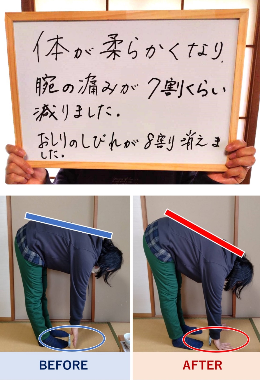 体が柔らかくなり、腕の痛みが7割くらい減りました。おしりのしびれが8割消えました。